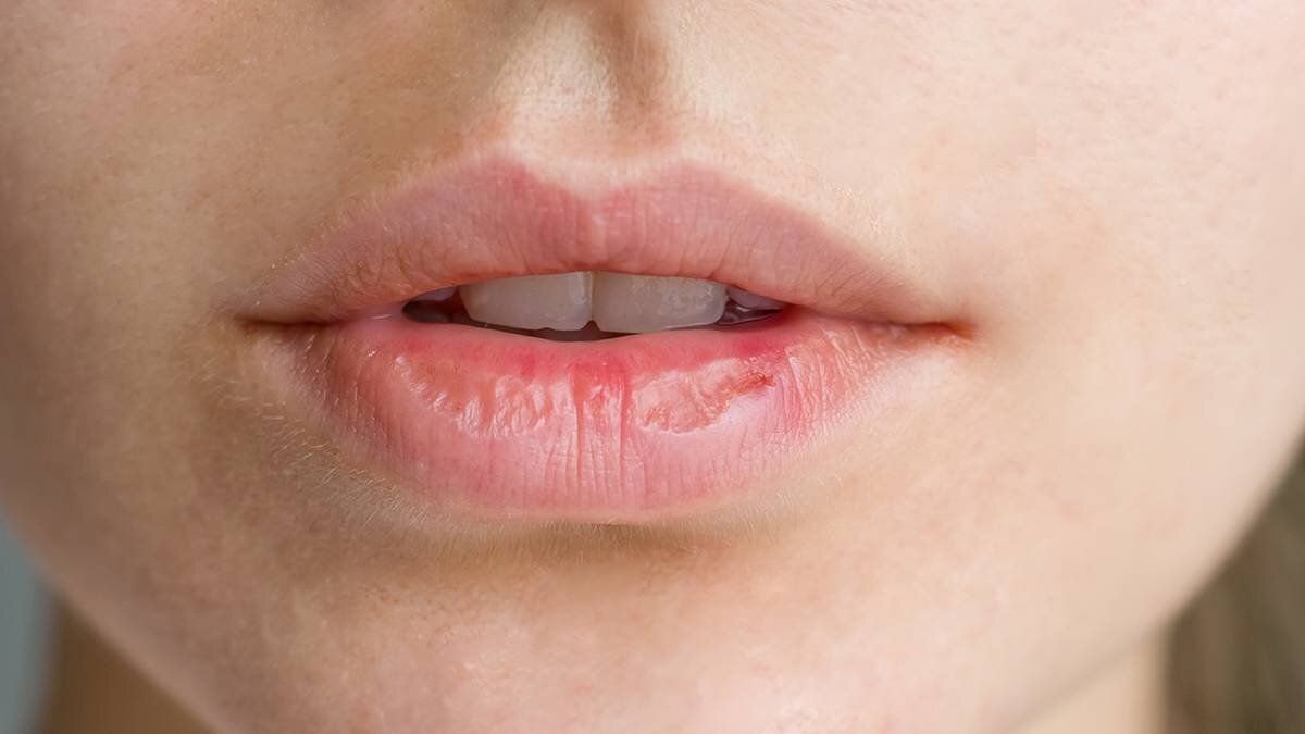    Фото: shutterstock