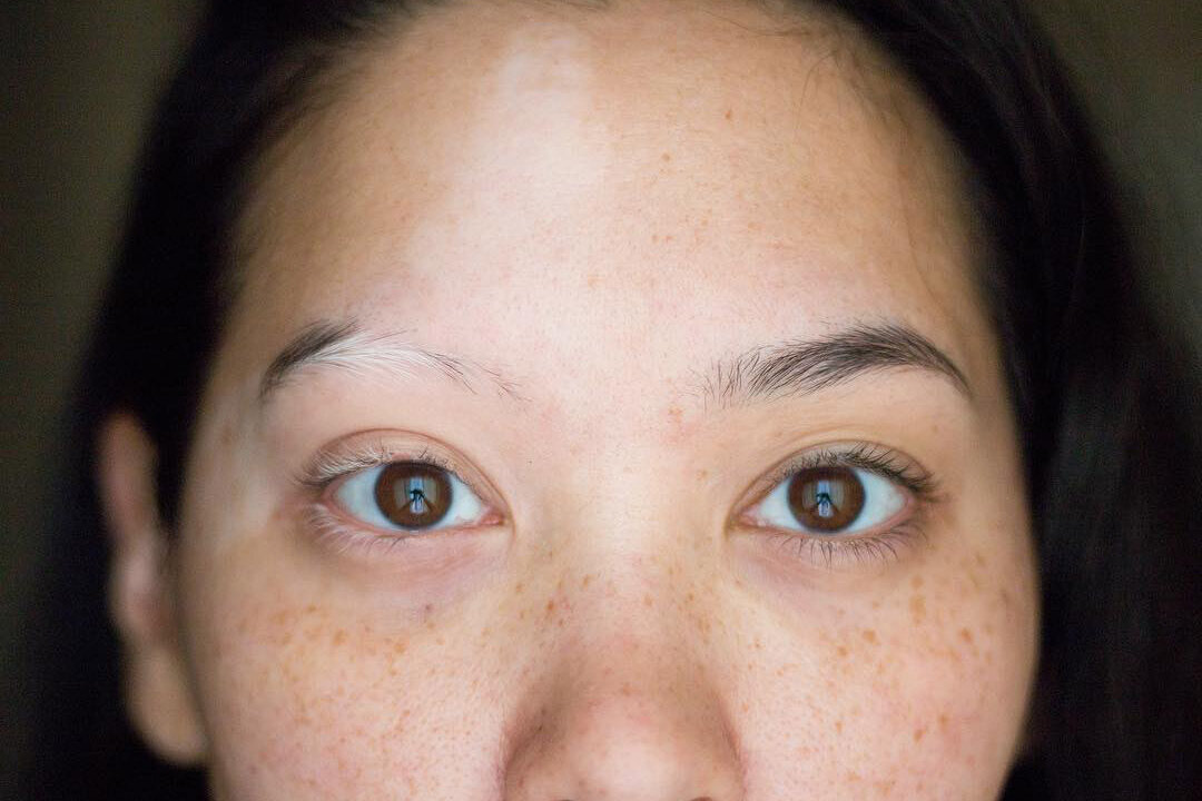     Что делать, если у тебя редеют брови: советы экспертов