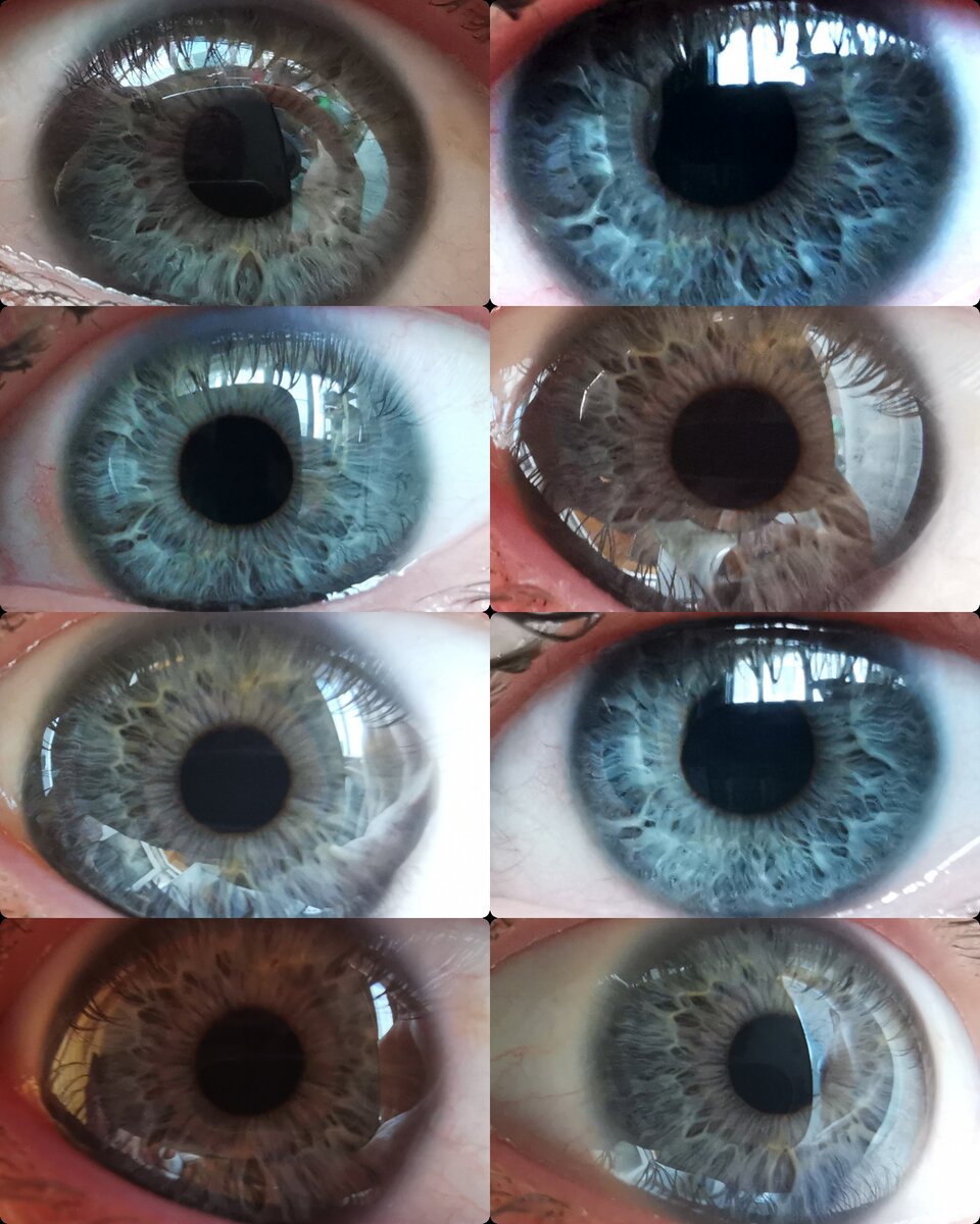 Почему глаза меняют цвет