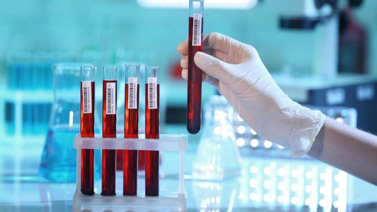    Ученые Томского государственного университета (ТГУ) и НИИ онкологии Томского научно-исследовательского медицинского центра (НИМЦ) разработали метод, который позволяет диагностировать рак кишечника на ранних стадиях по анализу крови пациента.