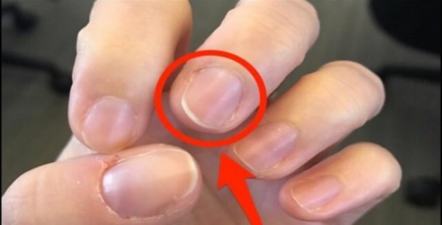 Фото с сайта https://helenkornilova.com/vnimanie-na-nogti-kakie-deficity-mozhn/