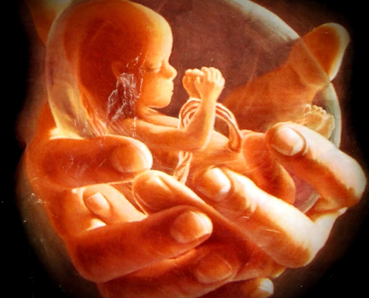 Фото: Яндекс-картинки