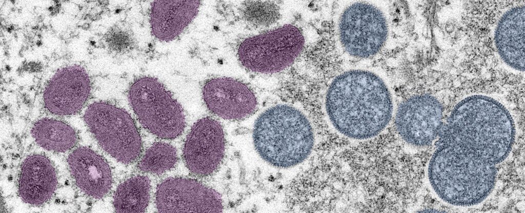 На снимке ниже: зрелые (слева) и незрелые (справа) частицы вируса оспы обезьян. Фото Cynthia S. Goldsmith & Russell Regnery/CDC.