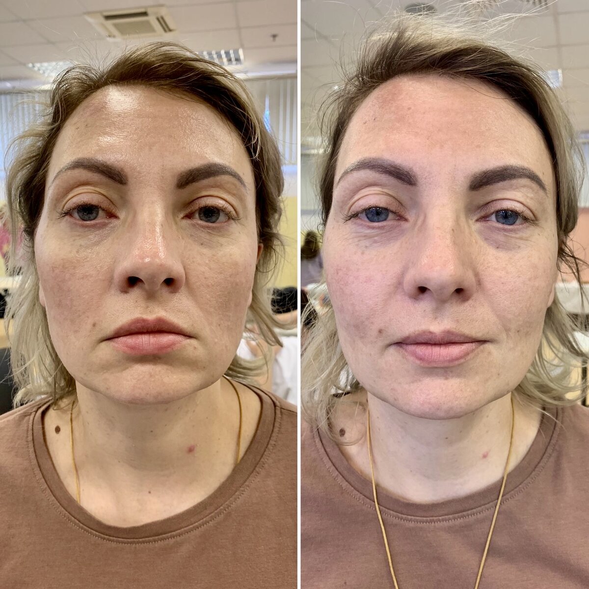 Фото «до/после» — результат работы с черепом. За 30 минут произошли изменения под нижней губой, раскрылись кости, лицо наполнилось объемом.
