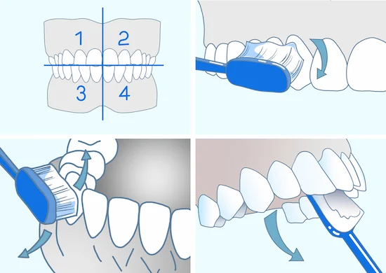 Классический метод чистки зубов