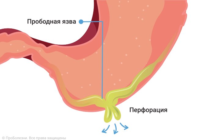 Хирургия желудка и двенадцатиперстной кишки