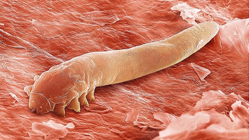 Клещ демодекс человека (Demodex folliculorum и Demodex brevis)