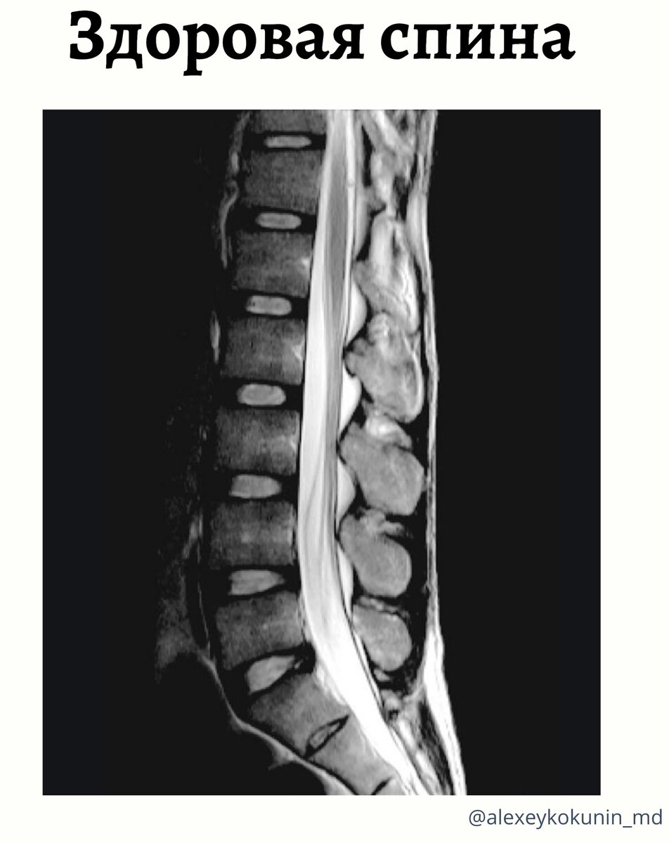 Боль в спине. Диагностика. | Занимательная диагностика | Pro.Diagnosi | Дзен