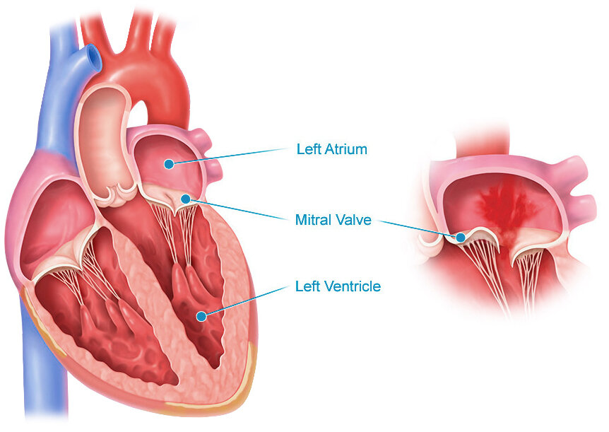 Mitral valve по-английски. Похож на парашютик на стропах-хордах.