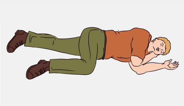Человек в устойчивом боковом положении. Так он не задохнется.