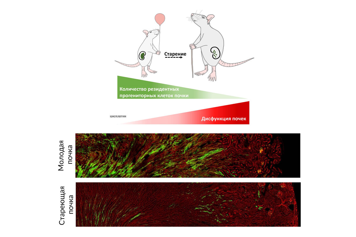 Ученые впервые доказали, что количество стволовых клеток в почках  уменьшается при старении | Российский научный фонд | Дзен