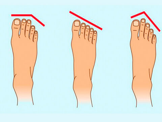Средняя стопа. Форма пальцев стопы. Половая Конституция по пальцам ног. Форма пальцев на ногах. Правильная форма пальцев на ногах.