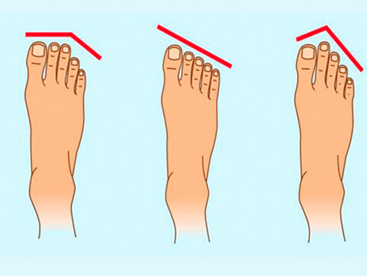 Форма пальцев стопы. Половая Конституция по пальцам ног. Форма пальцев на ногах. Правильная форма пальцев на ногах.