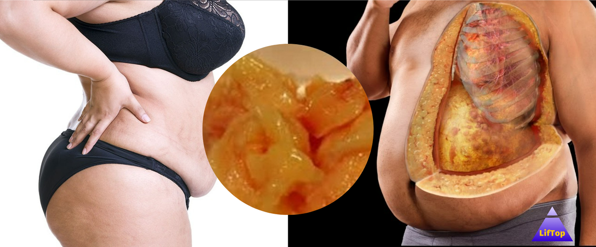 Почему при похудении не уходит живот