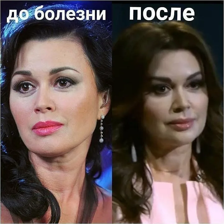 Как выглядит сейчас заворотнюк