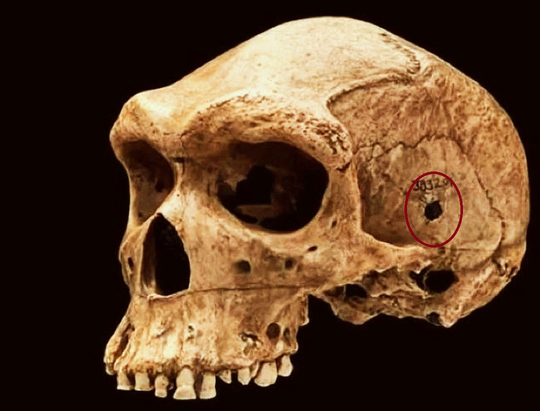 Отверстия в черепах. Череп хомо сапиенс и неандертальцы. Хомо сапиенс находки черепами. Череп доисторического человека.