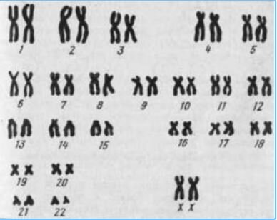 набор хромосом. 4 набора хромосом. 4 набора хромосом. набор хромосом, геном, кариотип. 4 набора хромосом.