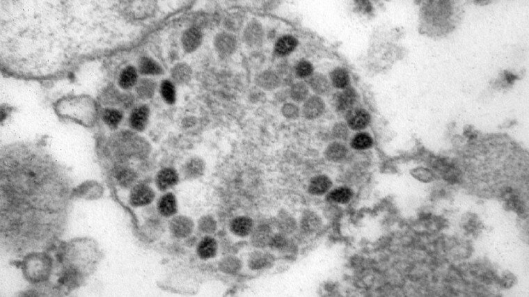 Фото: ТАСС / Пресс-служба Роспотребнадзора