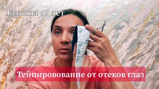 Тейпирование от отёков глаз