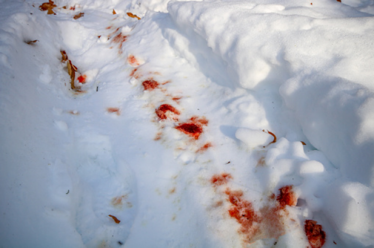    Прохожие в Казани ночью обнаружили истекающего кровью мужчину