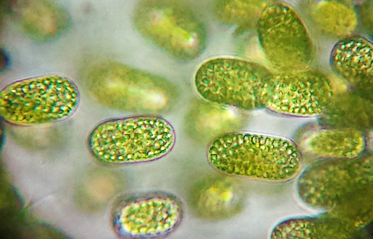 Автотрофные прокариоты. Цианобактерии и протисты. Синезелёные водоросли цианобактерии. Фотосинтезирующие цианобактерии. Цианобактерии сине-зеленые водоросли.