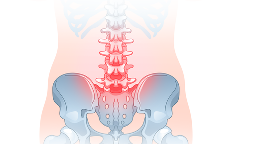 Болит крестец при сидении