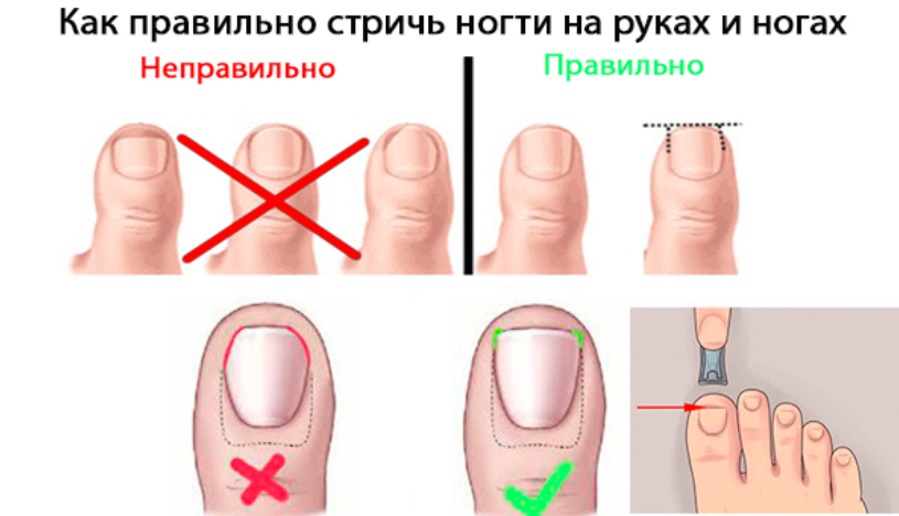 Как правильно: подстричься или постричься - Лайфхакер