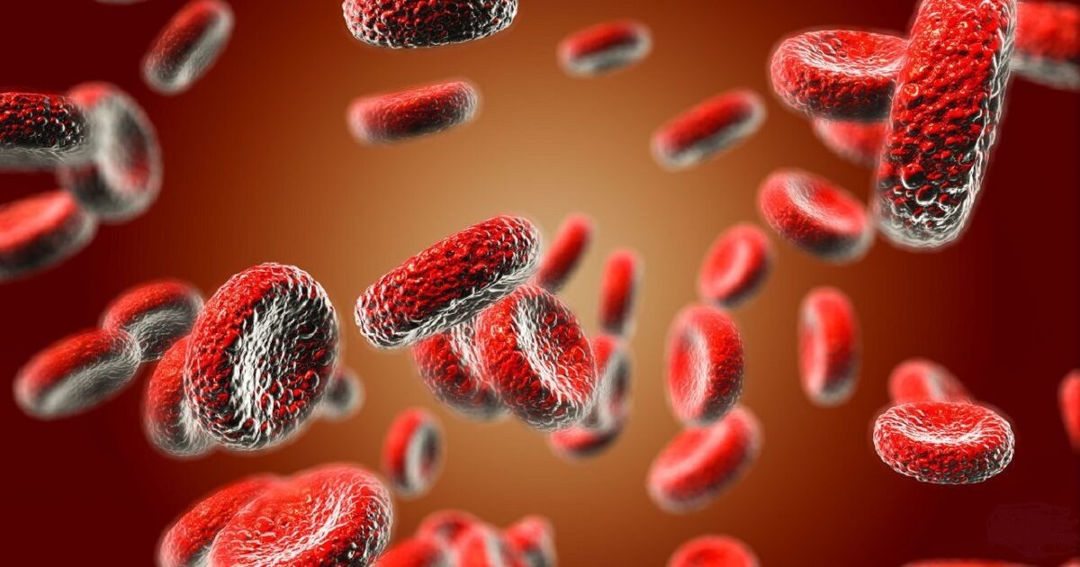 Анемия – состояние, характеризующееся уменьшением содержания гемоглобина в единице объема крови, вследствие снижения его общей концентрации в организме.-3
