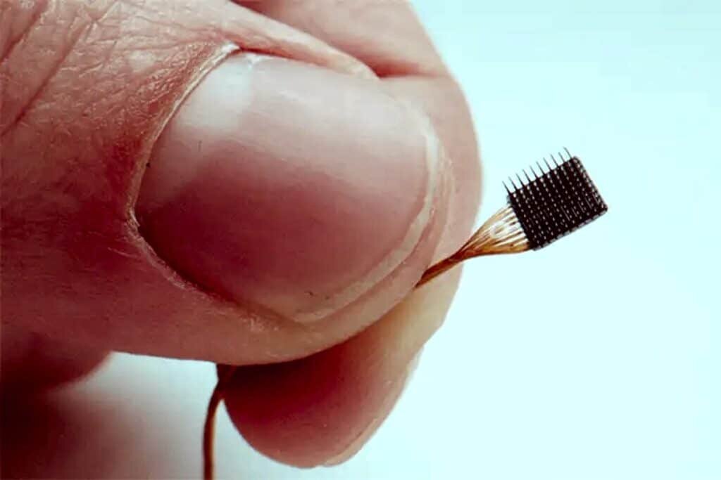    Массив микроэлектродов Utah / ©Blackrock