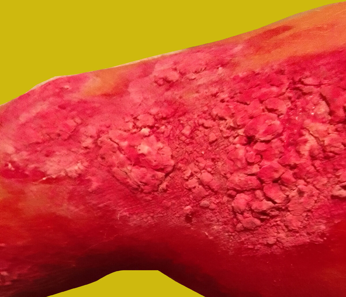 Зараза атакует