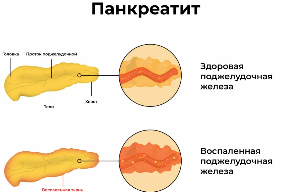 Фотография взята из источника sosud-ok.ru