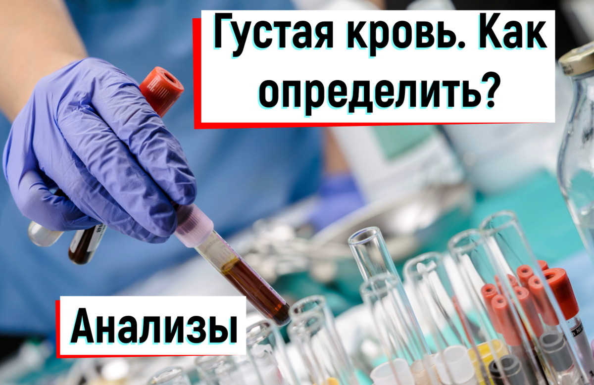 📌Признаки густой крови. Анализы🔎, характерные для синдрома повышенной ...