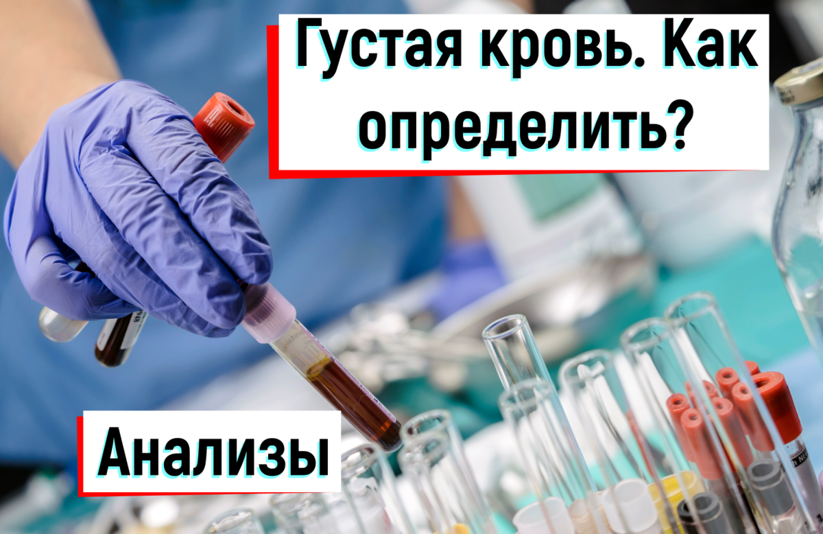 В этой статье мы разберем главные составляющие, которые достоверно отражают повышенную вязкость крови (густую кровь).