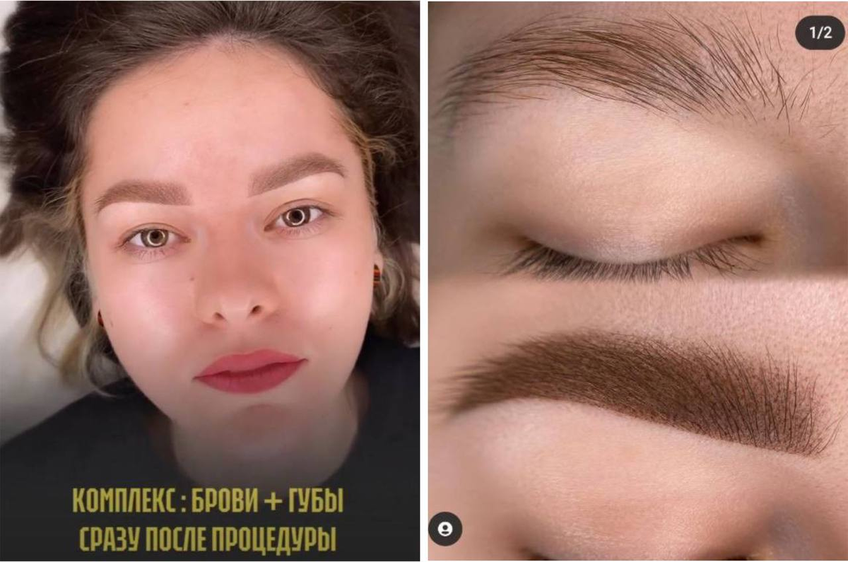 Сразу после процедуры