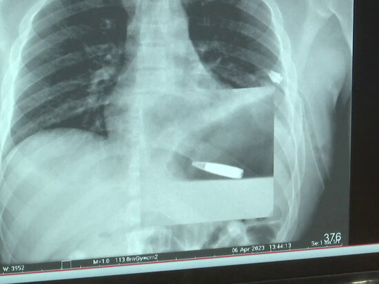   Кадр из видео