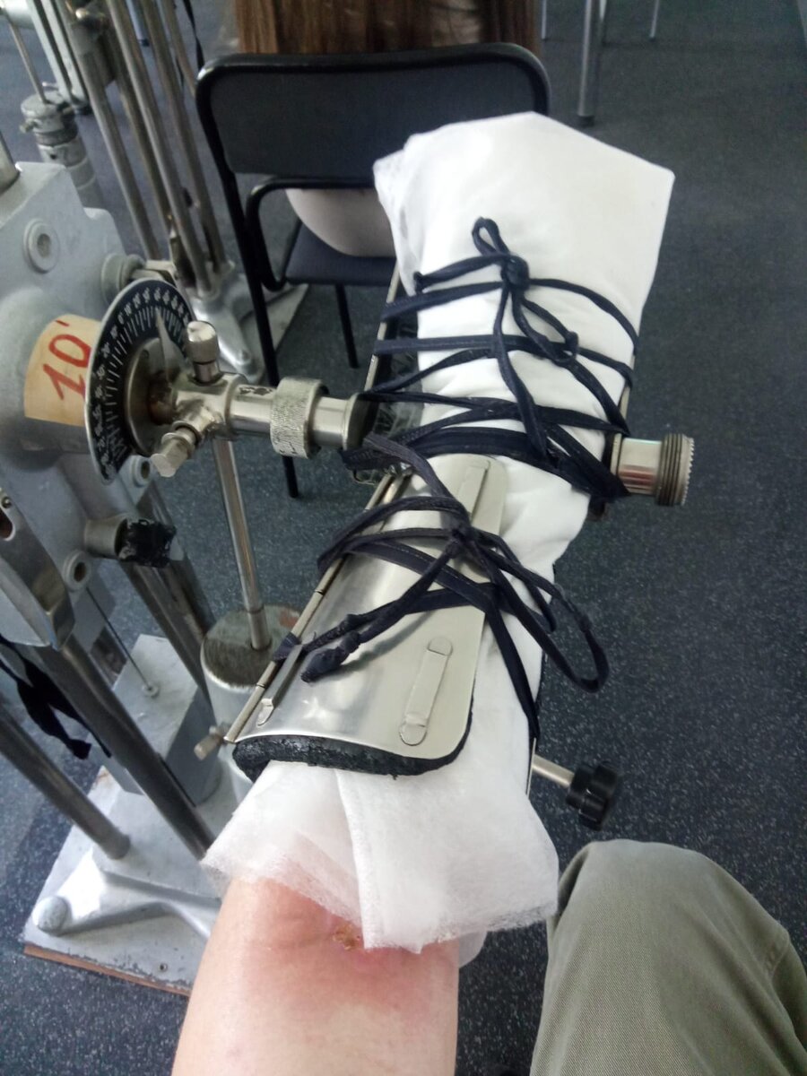 Сейчас пациент находится на реабилитации