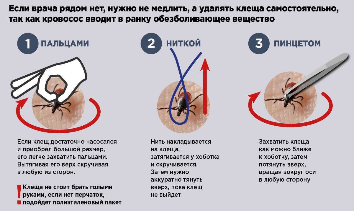 Картинка взята из открытого доступа