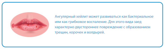 Что делать если трескаются уголки губ