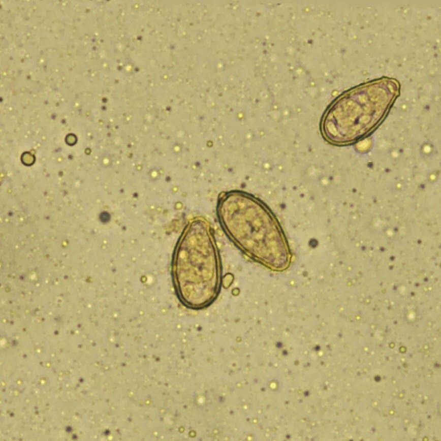 Так описторхи выглядят при рассмотрении под микроскопом