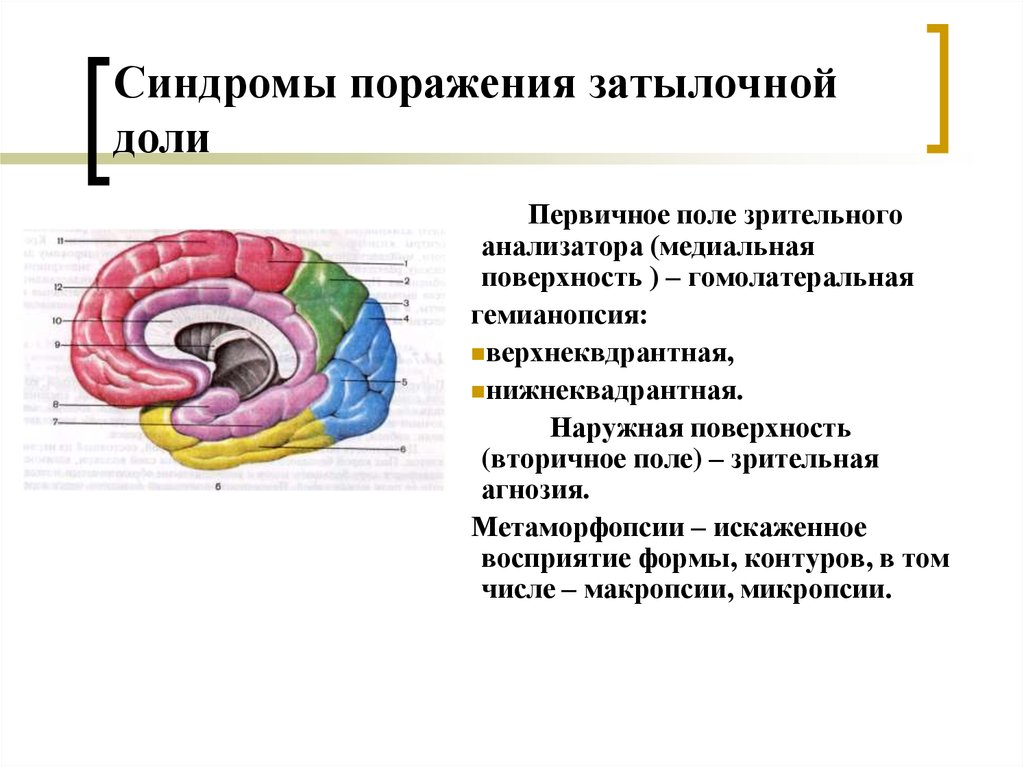 Поражение долей. Поражение затылочной доли головного мозга симптомы. Симптомы поражения затылочной доли неврология. Симптомы пораженизатылочной доли неврология. Клиника поражения затылочной доли головного мозга.