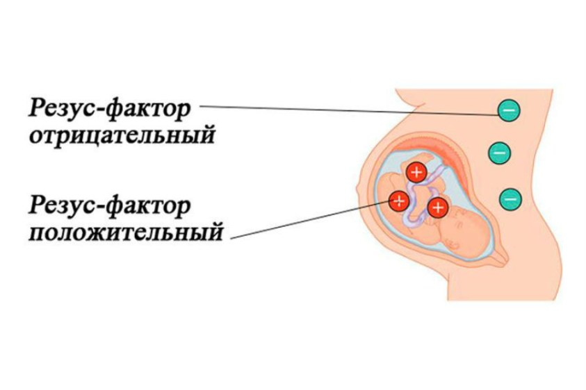 Что такое резус-фактор