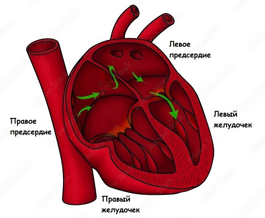 Анатомия сердца. Ток крови через открытое овальное окно. 