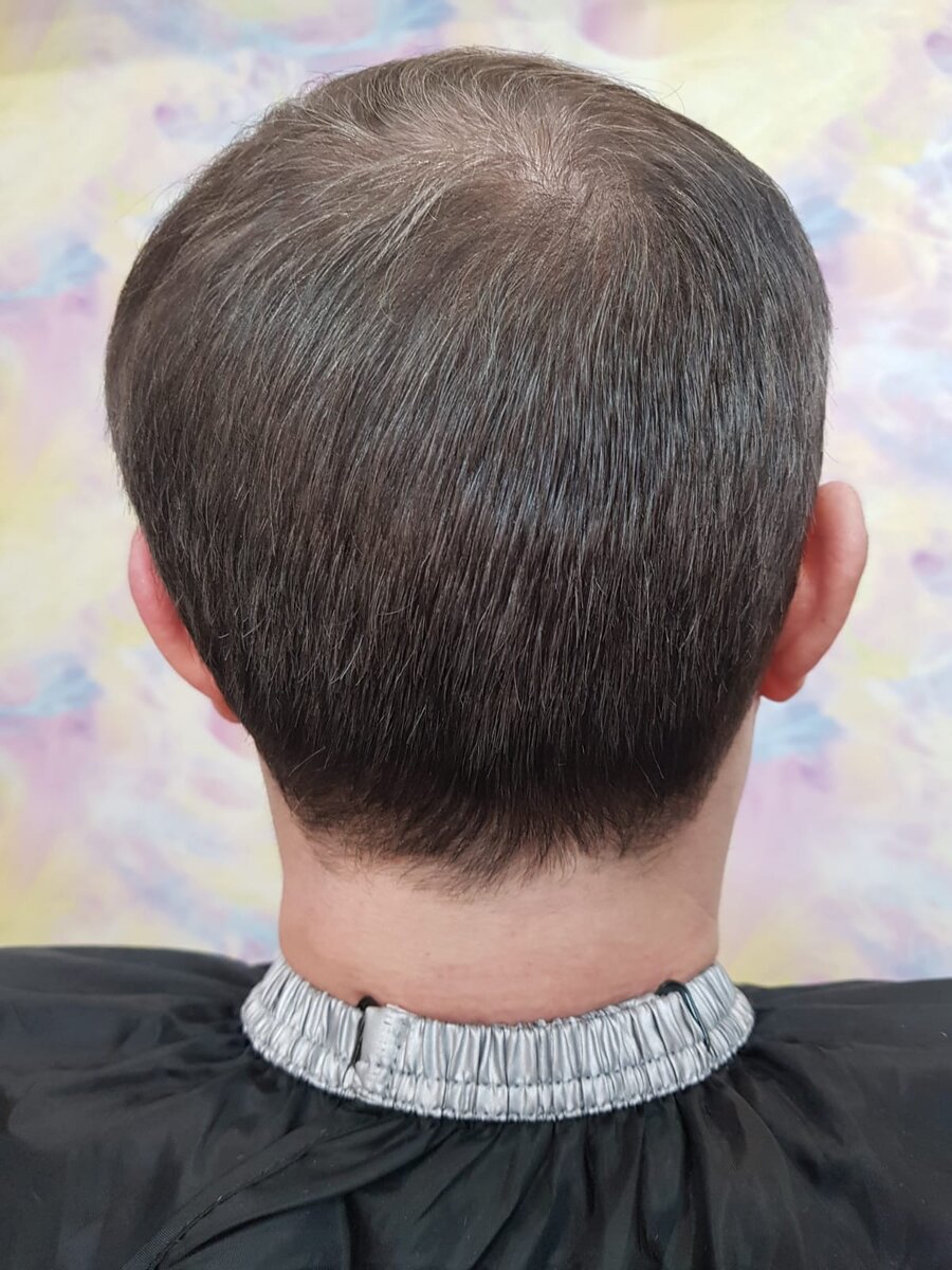 После процедуры