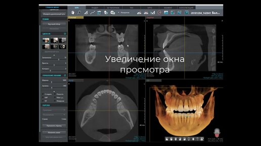 Ez3d2009. VATECH программа. Ez3d Plus. Программа ez3d Plus.