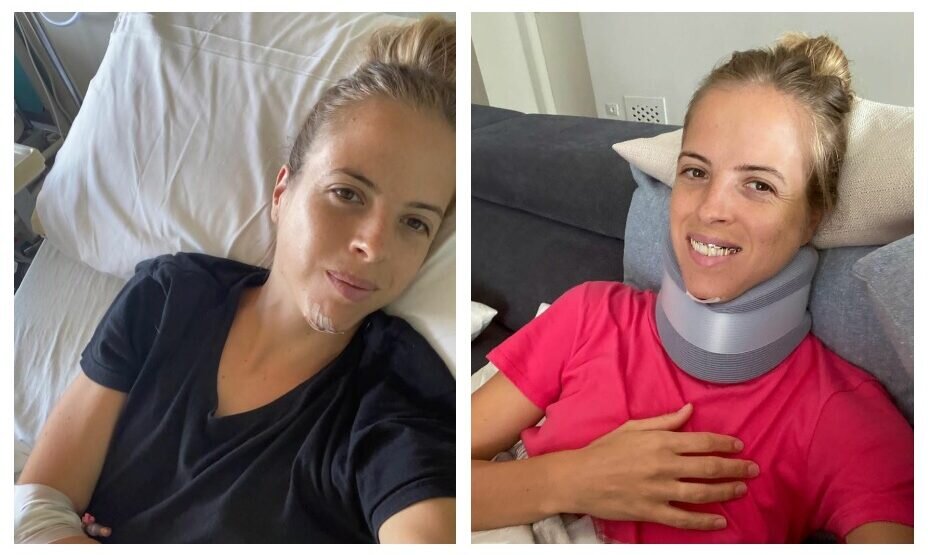    Костнер пережила операцию, в которой ей наложили пять швов. Фото: соцсети Каролины Костнер