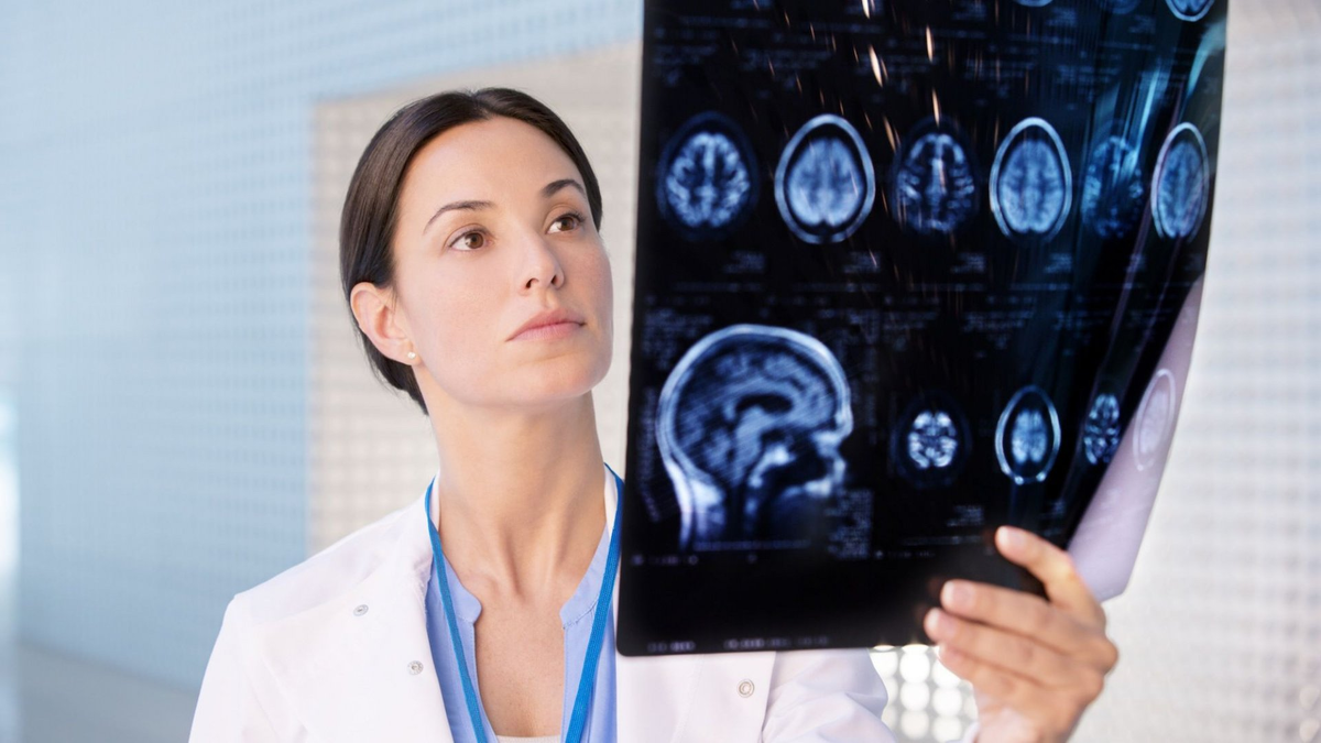 Uneori, medicul dumneavoastră local sau alt specialist vă va trimite la un neurolog.  Dar de ce se face asta? -5