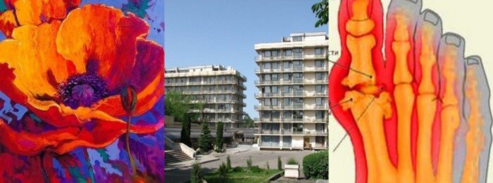 лечение подагры в санаториях  Пятигорска http://kmv-voyage.ru/