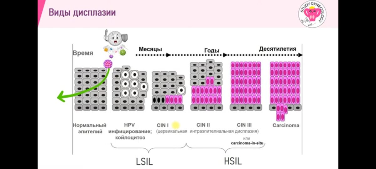 З т 2 типа. З т 2 типа