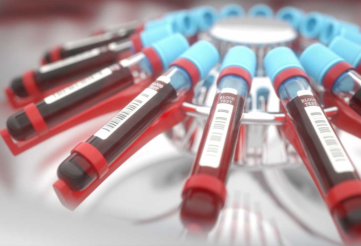 лечение сепсиса и септического шока 