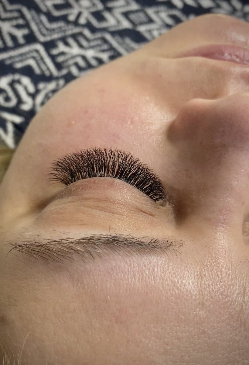 Фото ПОСЛЕ. Объём 3D.